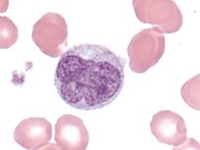 normal monocytes