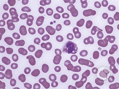 Leukocyte Phagocytosis of Platelets - 3.