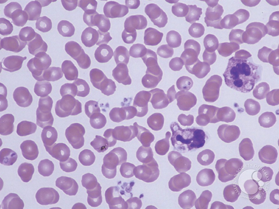 Leukocyte Phagocytosis of Platelets - 5.