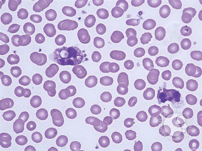 Leukocyte Phagocytosis of Platelets - 6.