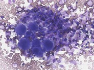 Look-alikes: Hematopoietic cluster vs. extrinsic cells - 1.