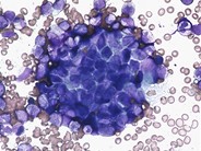 Look-alikes: Hematopoietic cluster vs. extrinsic cells - 2.