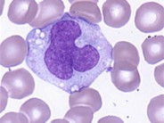 normal monocytes