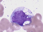 normal monocytes