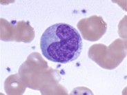 normal monocytes