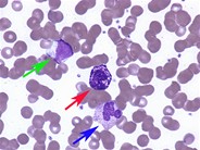 Granulated white cells - peripheral blood - 1.