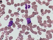 Cytogram - normal peripheral blood - 4.