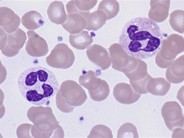 Cytogram - normal peripheral blood - 6.