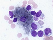 Histiocyte - 1.