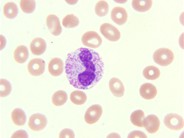 G-CSF effect - 2.