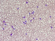 Peripheral blood response to G-CSF - 2.