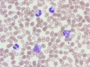 Peripheral blood response to G-CSF - 4.