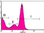 Paroxysmal nocturnal hemoglobinuria - 1.