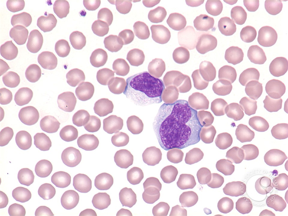 download chiral diazaligands for asymmetric