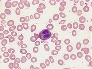 eosinophils-2