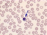 nucleated-red-blood-cell-1