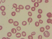 Stomatocytes - 1.