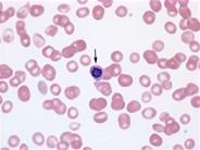 Nucleated red blood