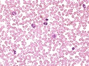 Eosinophils - 1.