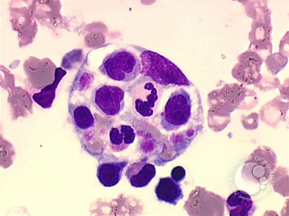 A hungry macrophage - 1.