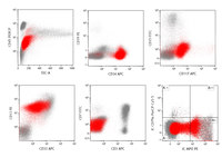 Acute myeloid leukemia with myelodysplasia related changes flow