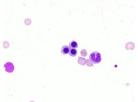 polychromatophilic normoblast