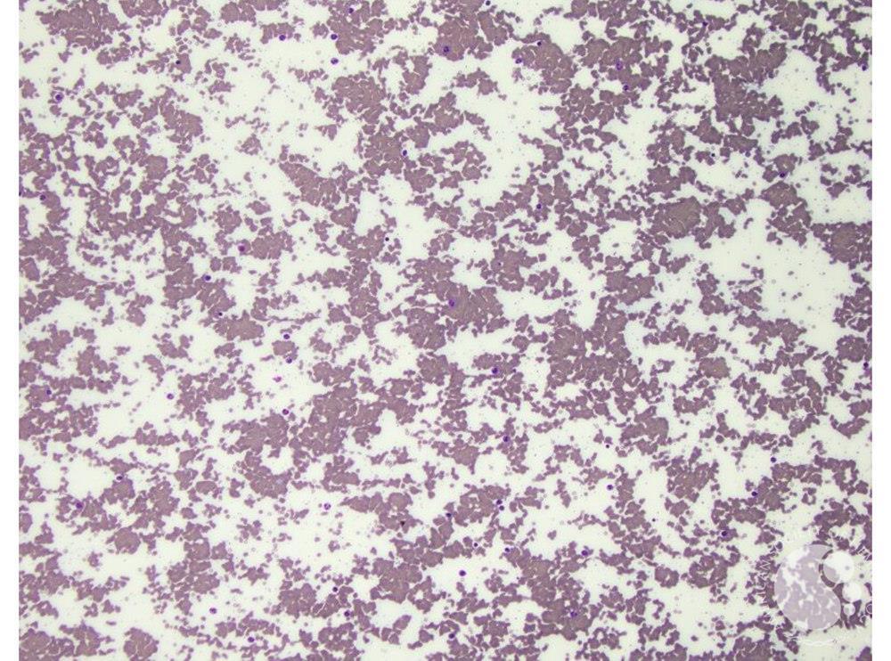 Red cell agglutination