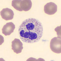 band neutrophil pathology