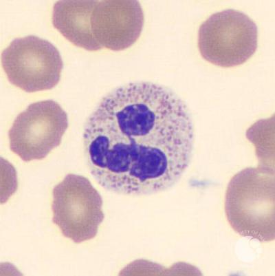 Segmented neutrophil