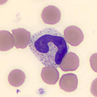 Band Neutrophil