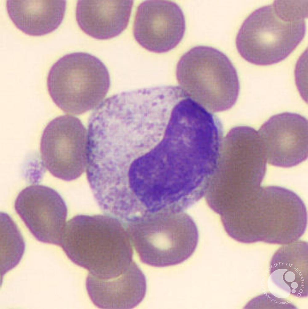 Metamyelocyte