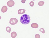 hypersegmented-neutrophil