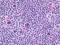 Scattered-HRS-cells-HE-high-power