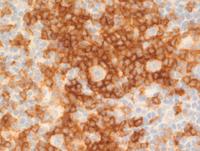 PD1-staining-in-Tcell-rosettes