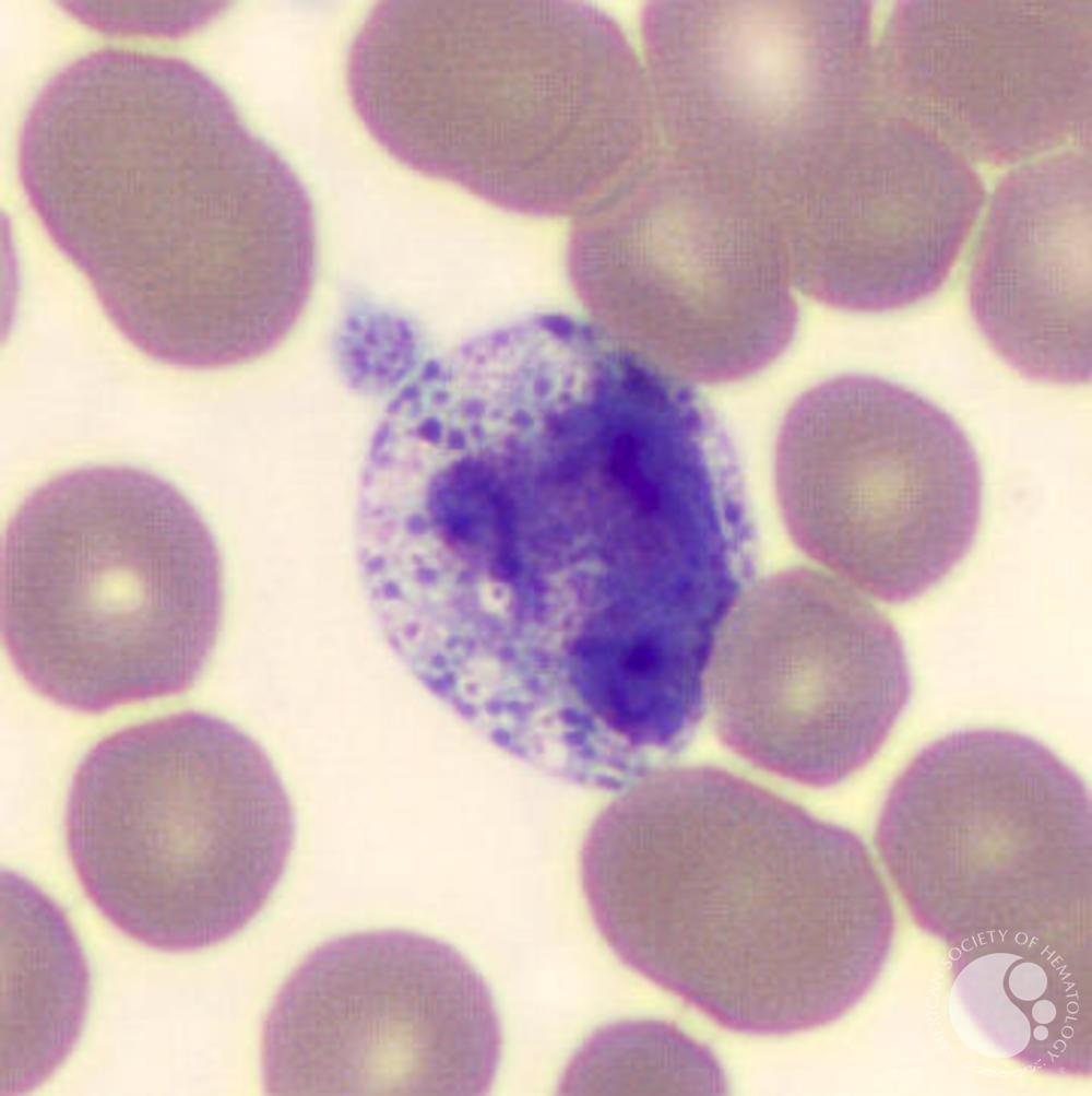 Basophil with washed out granules