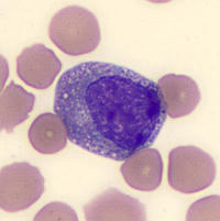 myelocyte and metamyelocyte