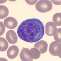 Reactive Lymphocytes Vs Monocytes