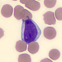 Reactive lymphocyte