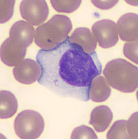 reactive-lymphocyte