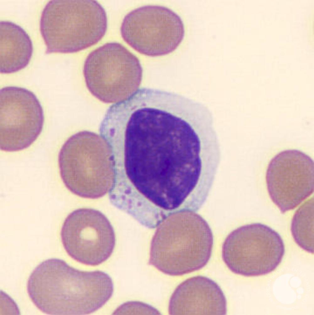 Large granular lymphocyte