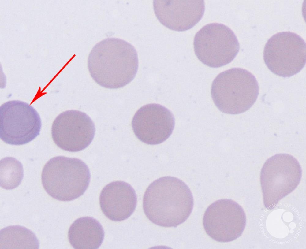 Кольца кебота фото Кольца кебота фото