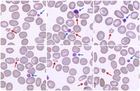 Small red blood cells mimicking platelets