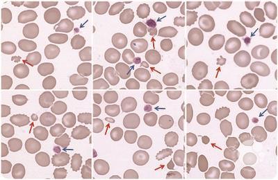 Small red blood cells mimicking platelets