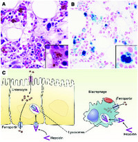 Iron-laden macrophage in autoimmune disease