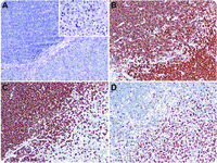 Caught in transformation