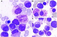 Fish negative morphology positive 
