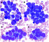 T cells in bone marrow