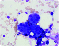 You GATA look at the marrow!