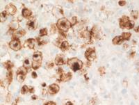 GZL CD15 IHC