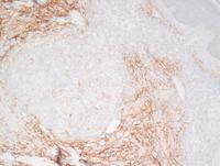 CD10-IHC-CMZL